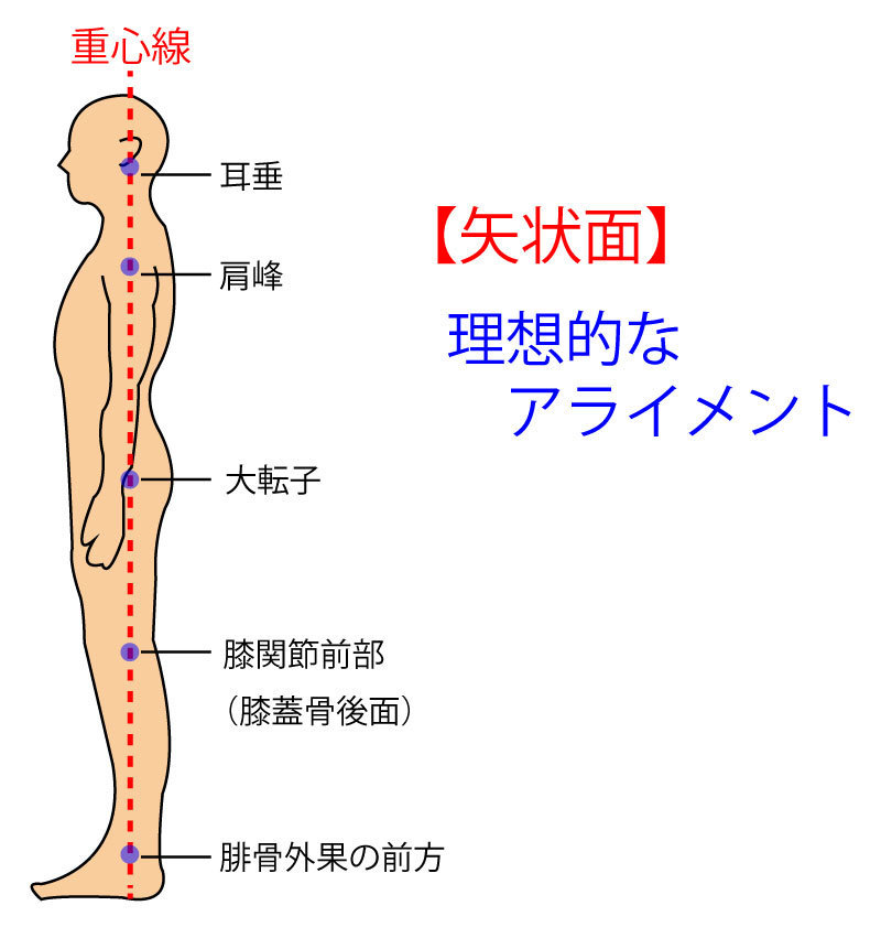 理想的なアライメント画像