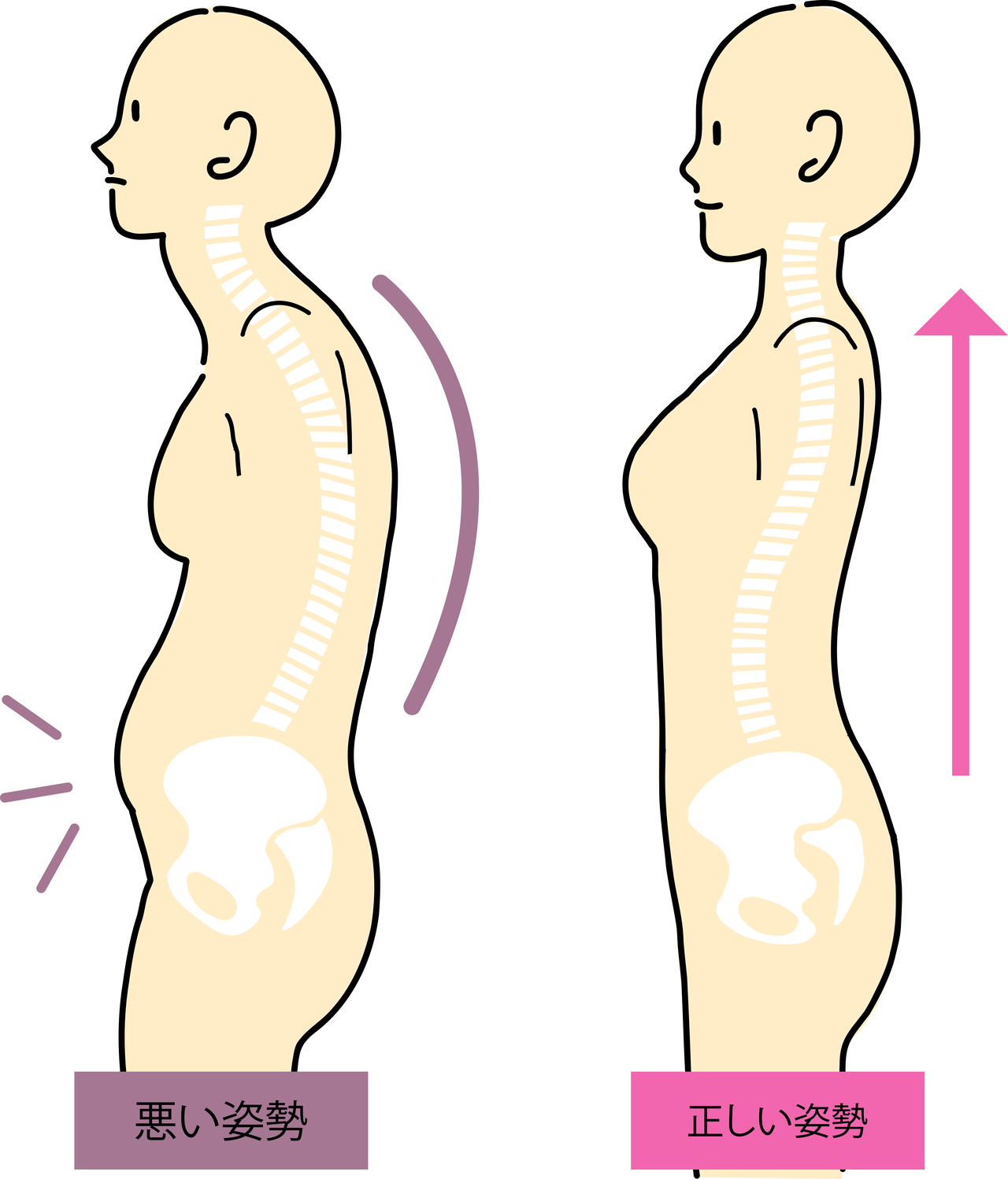 悪い姿勢と良い姿勢のイラスト