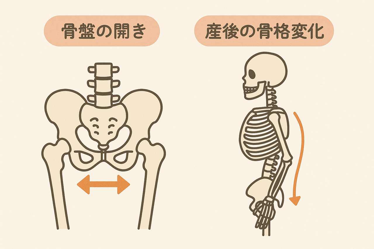 骨盤と背骨のゆがみのの説明
