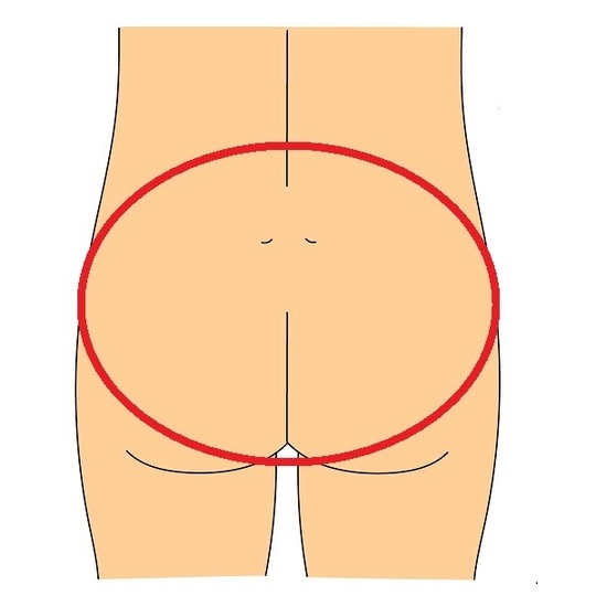 腰痛の範囲の定義の画像