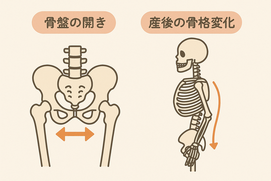 骨盤と背骨のゆがみのの説明